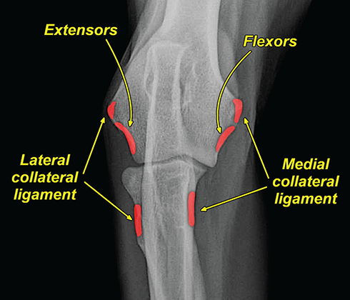 Photograph of normal elbow.
