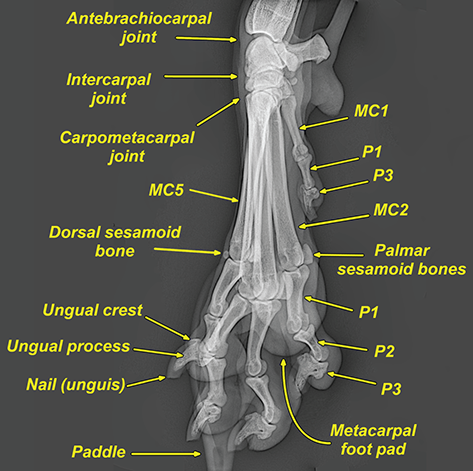 Photograph of normal foot.