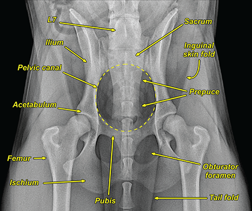 Photograph of normal pelvis.