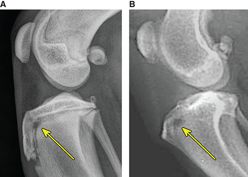 Photograph of tibial cartilage rest.