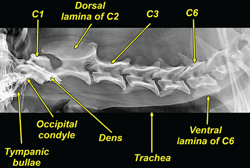 Photograph of normal cervical vertebrae.