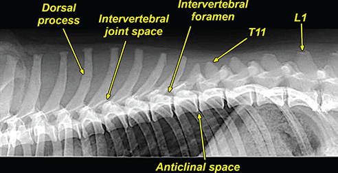 Photograph of normal thoracic vertebrae.