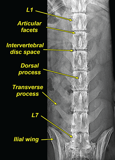 Photograph of normal lumbar vertebrae.