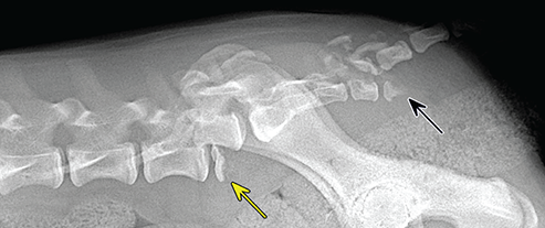 Photograph of overriding fractures.
