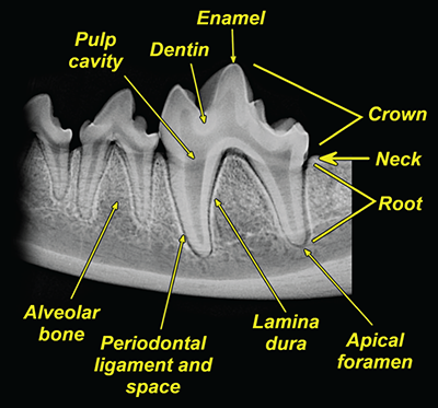 Photograph of normal tooth.