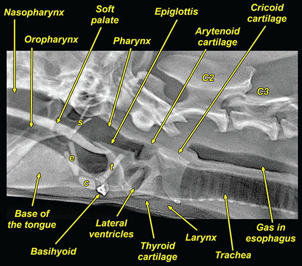 Photograph of normal pharynx and larynx.