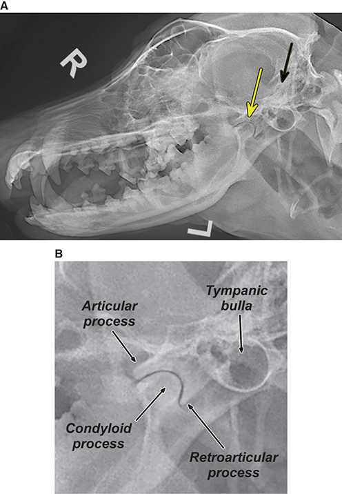 Photograph of normal temporomandibular joint.