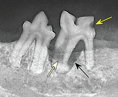Photograph of dental disease.