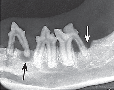 Photograph of dental disease.