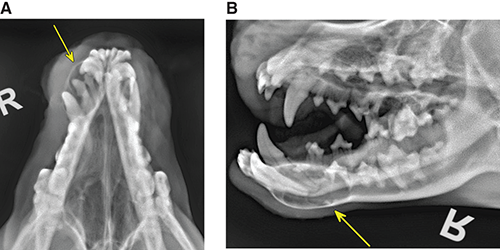 Photograph of dentigerous cyst.