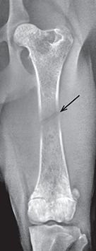 Photo depicts Stages of unncomplicated fracture healing- 5–10 days.