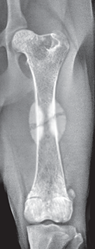 Photo depicts Stages of unncomplicated fracture healing- 10–20 days.