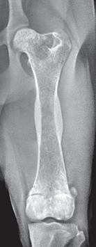 Photo depicts Stages of unncomplicated fracture healing- 30–40 days.